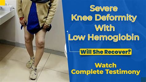 Unilateral Knee Replacement Surgery Serious Knee Pain With Low