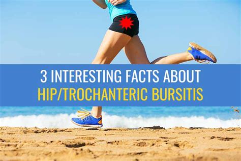 3 Interesting Facts About Hiptrochanteric Bursitis Sports Injury Physio