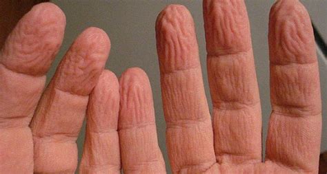 Your Pinky Finger Reveals A Lot About You Crazeportal