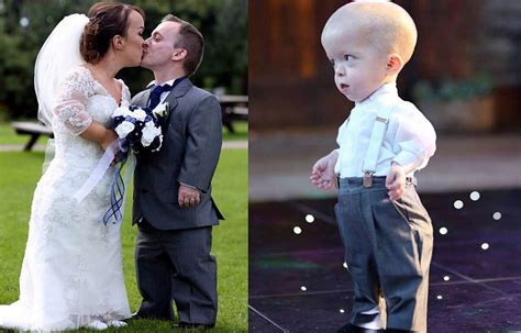 Couple With Dwarfism Get Married With Their Son Doctors Advised To