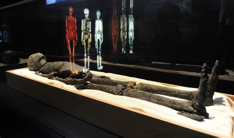 Oldest Prosthetic Ever Found On Egyptian Mummy The World From Prx
