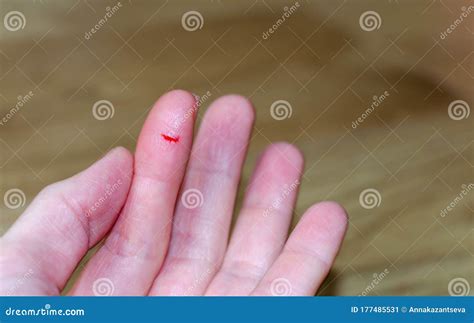 Bleeding From Sharp Cut Wound At Left Index Finger Cut Bleeding