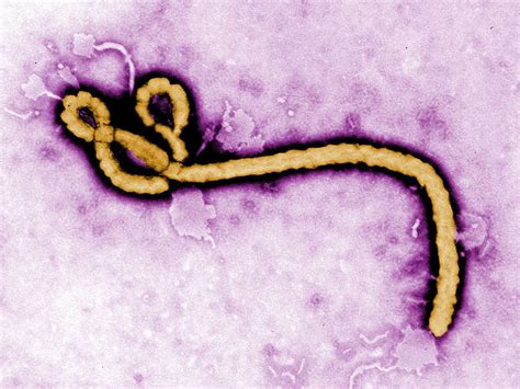 Ebola Virus Life Cycle And Pathogenicity In Humans Ask Scientific