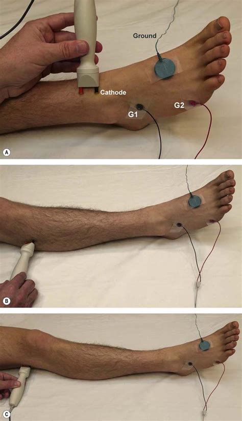 Routine Lower Extremity Nerve Conduction Techniques Neupsy Key