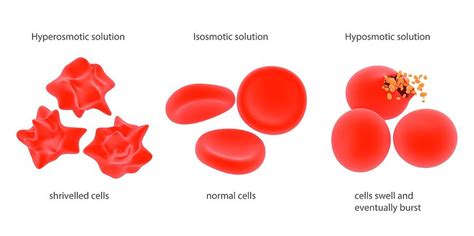 Osmosis In Red Blood Cells 1 Photograph By Science Photo Library