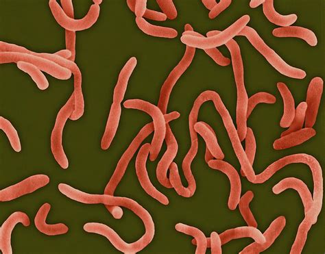 Vibrio Cholerae Photograph By Dennis Kunkel Microscopyscience Photo