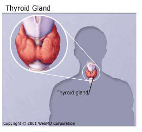 Read about the symptoms of thyroid problems such as constipation, insomnia, tremors, frequent bowel movements, excessive sweating, joint pains, dry cough, fever, and carpal tunnel syndrome. Graves' Disease - What is Graves' Disease and What Causes It?