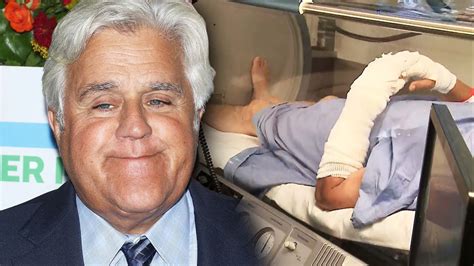 Jay Leno Undergoes Treatment For Severe Burns From Car Fire Youtube