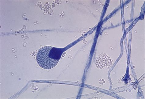 Filemature Sporangium Of A Mucor Sp Fungus Wikimedia Commons