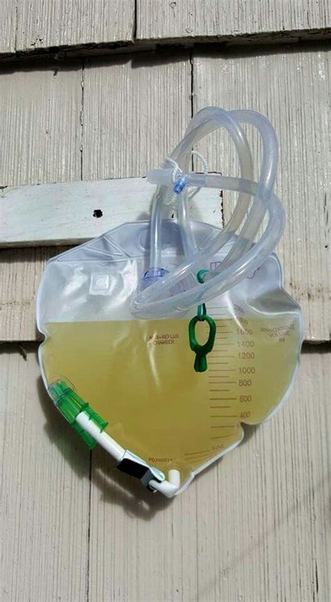 Corticosteroid binding globulin cannabigerol capillary blood glucose capillary blood gas if you know which context it is being used in, the. Margarita in a catheter bag- nurses have a twisted sense ...