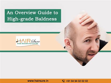 An Overview Guide To High Grade Baldness Hair Sure