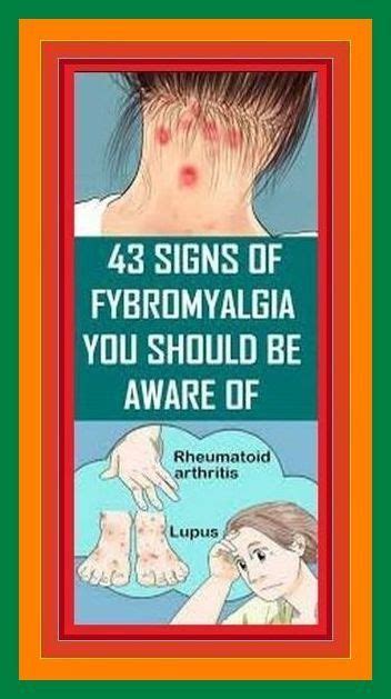 43 Signs Of Fibromyalgia You Should Be Aware Of In 2022 Signs Of