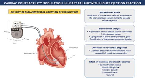 Role Of Cardiac Contractility Modulation In Heart Failure With A Higher
