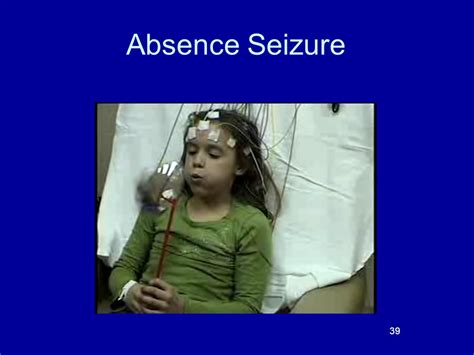 Pediatric Epilepsy An Overview And Update On Treatment Options Ppt