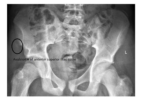 Imaging Case of the Week 307 Answer | Emergucate