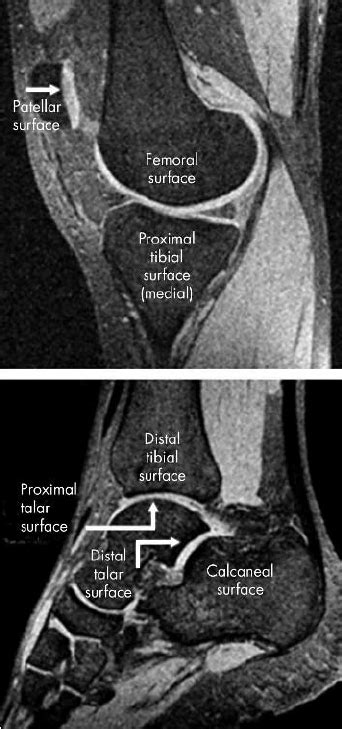 Sagittal Magnetic Resonance Images Of The Knee And Ankle Acquired With