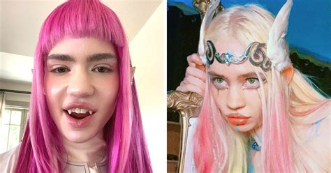 Grimes Shows Off Bandaged Face After Saying She Wanted Elf Ear Surgery