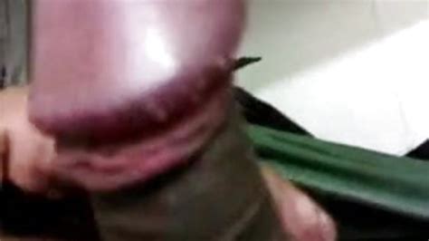 Small Cock Covered Pearly Penile Sexy Pics Hot