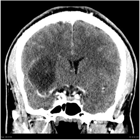 A Collection Of Surgical Pathology Images