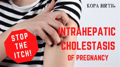 Stop The Itch Intrahepatic Cholestasis Of Pregnancy • Kopa Birth®
