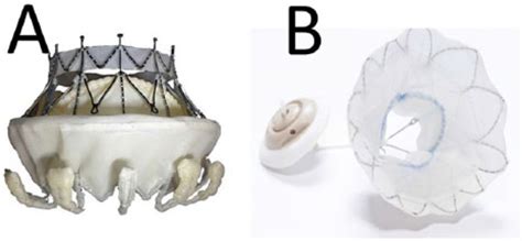 Mitral Valve Replacement—current And Future Perspectives Johan Van