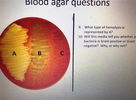 Solved Blood Agar Questions 9 What Type Of Hemolysis Is