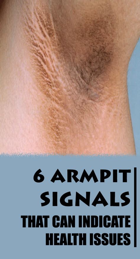 6 Armpit Signals That Can Indicate Health Issues Health Overdosed