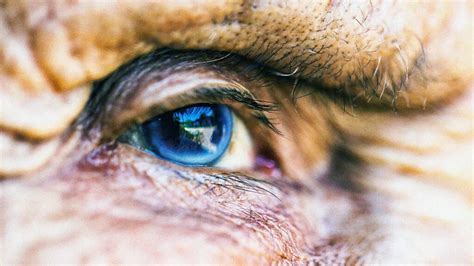 Diabetes And Cataracts Link Causes Signs And Treatment