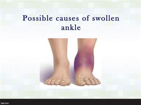 Right Ankle Swelling Causes