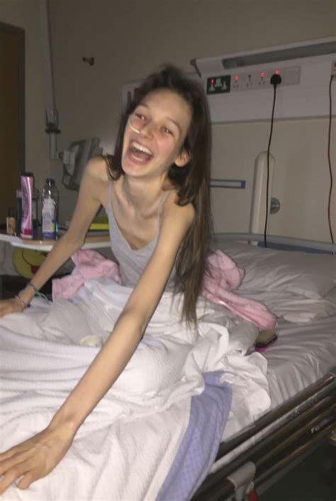 Irish Teen Reveals Her Anorexia Would Have Killed Her If She Didnt