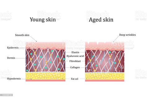 Vector Illustration Of Agerelated Changes In The Skin Comparison Of