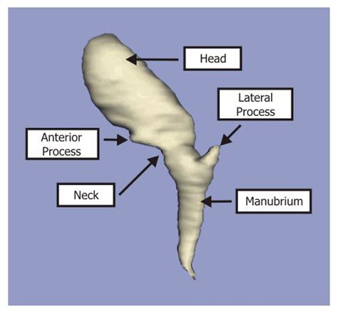 Malleus Has A Head A Neck And Three Processes Anterior Process