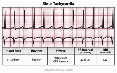 Ekg Review A2 Cardiothoracic Unit