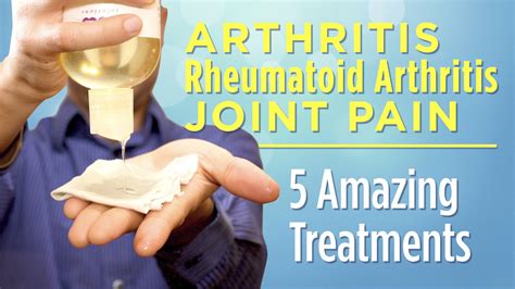 5 Amazing Treatments For Arthritis Rheumatoid Arthritis And Joint