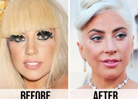 Lady Gaga Plastic Surgery Everything The Actress Singer Has Admitted To Throughout The Years