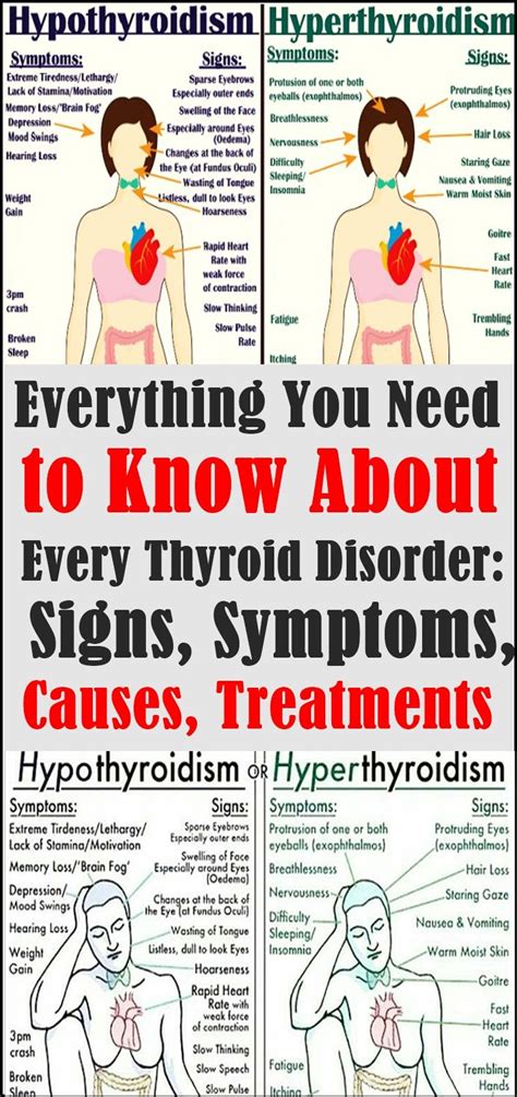 Everything You Need To Know About Every Thyroid Disorder Signs
