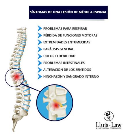 Grava Lobo Con Clasificacion De Las Lesiones De La Medula Espinal En