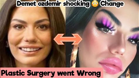 Demet Ozdemir Finally Talk About Her Plastic Surgery Shocking Change