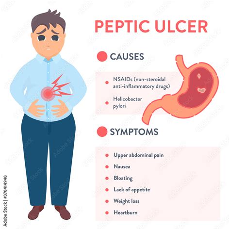 Types Of Peptic Ulcer Stomach Disease Infographics Cartoon Vector The