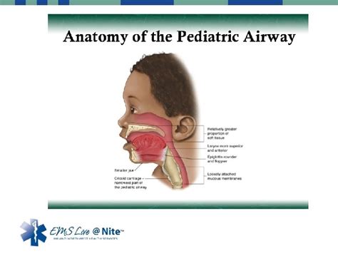 Pediatric Airway Management Brian Rogge Rn Emt P Pediatric