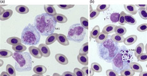 Maybe you would like to learn more about one of these? a. Four large monocytoid cells expressing a size range of ...