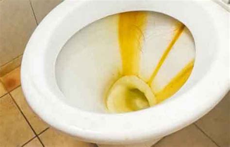 Causes Of Yellow Stains In Toilet Bowlhow To Remove And Prevent Toiletseek