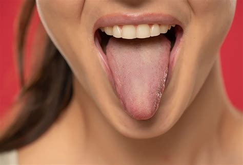 What Does A Healthy Tongue Look Like The Well By Northwell