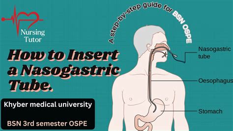 How To Insert Nasogastric Tube Ng Tube Insertion Procedure Bsn 3rd