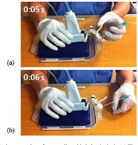 Figure 1 From Simple And Effective Ultrasound Needle Guidance System