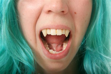 Humans With Sharp Canine Teeth