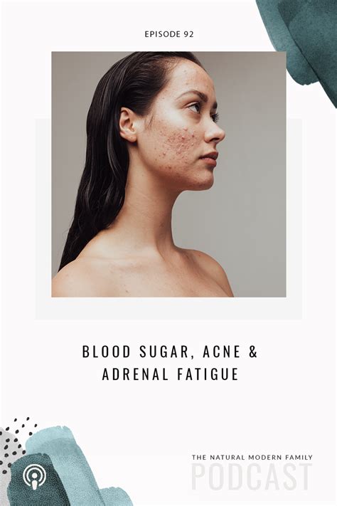 92 Blood Sugar Acne And Adrenal Fatigue Elevays