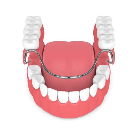 Partial Dentures Stock Photos Pictures And Royalty Free Images Istock