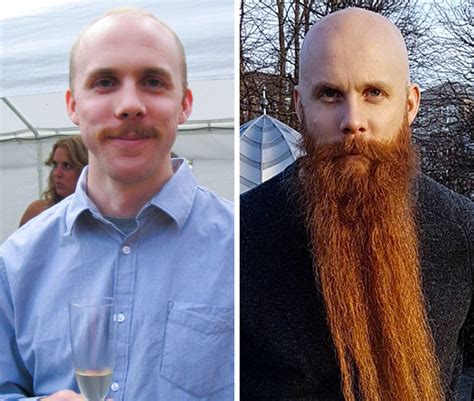 20 Before And After Photos That Prove Beards Can Make A Man More