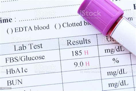 Diabetes Test Results Stock Photo Download Image Now Istock